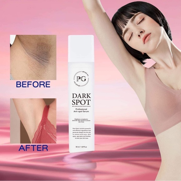 PG Dark Spot Whitening Serum 50ML - Picture 2 of 8